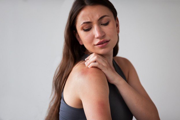 que es la dermatitis atopica